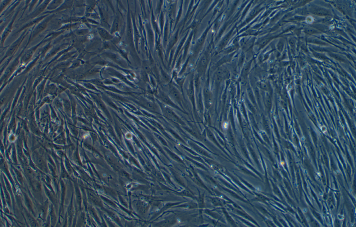 人乳腺浸润性导管癌旁皮肤细胞CCD-1095Sk(STR鉴定正确)