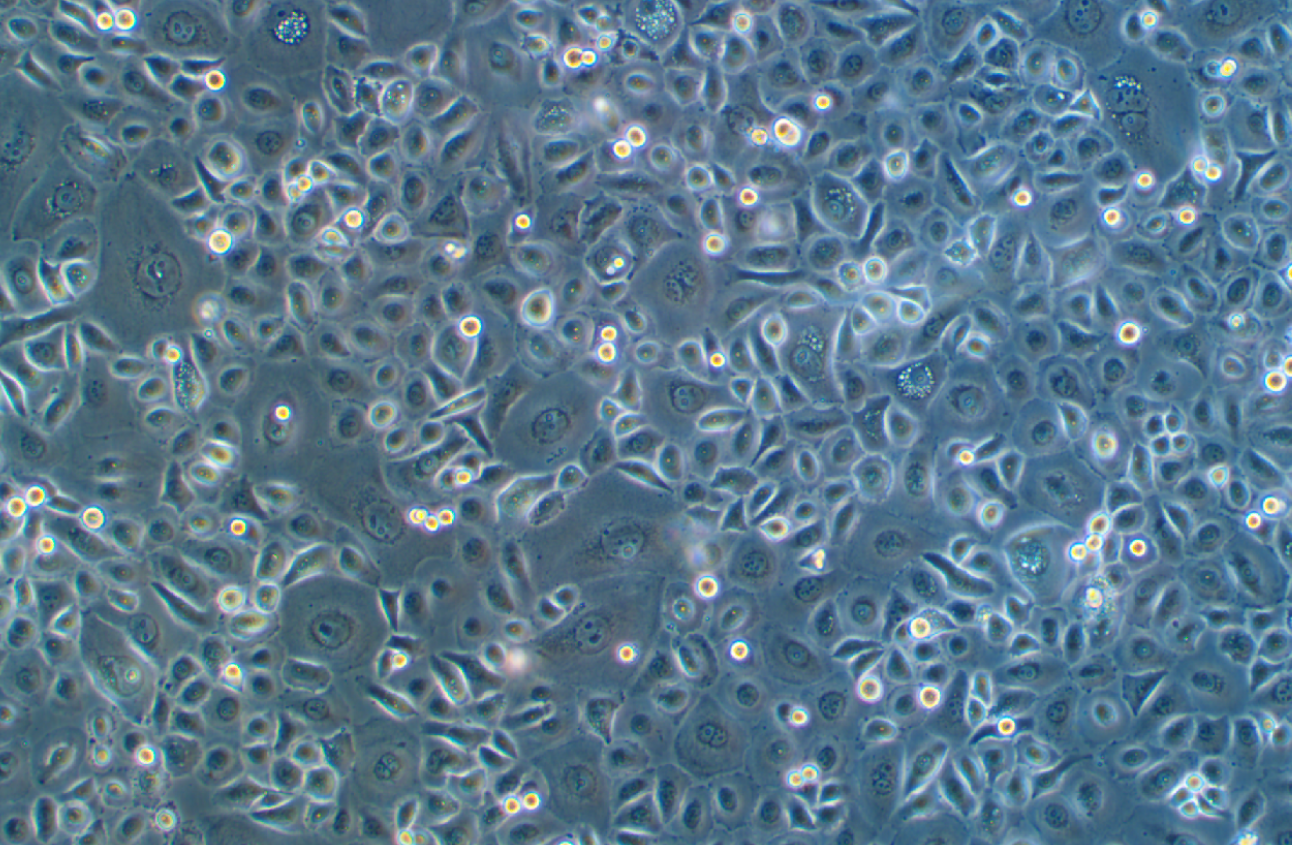 人非小细胞肺癌奥希替尼耐药株PC-9+Osimertinib