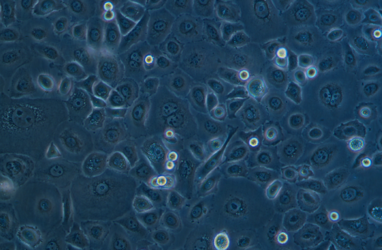 人非小细胞肺癌奥希替尼耐药株PC-9+Osimertinib