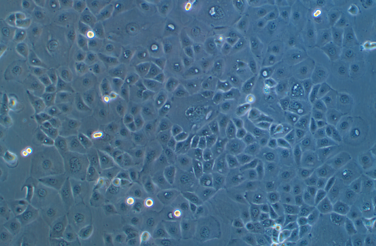 人卵巢癌腺癌细胞带绿色荧光NIH:OVCAR-3+GFP(STR鉴定正确)