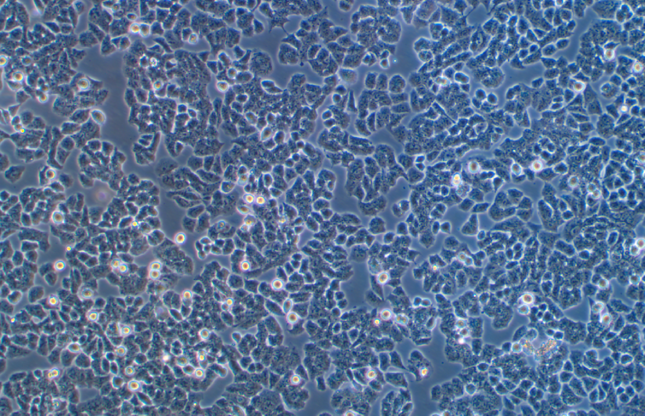 人卵巢癌顺铂耐药株A2780+DDP(STR鉴定正确)