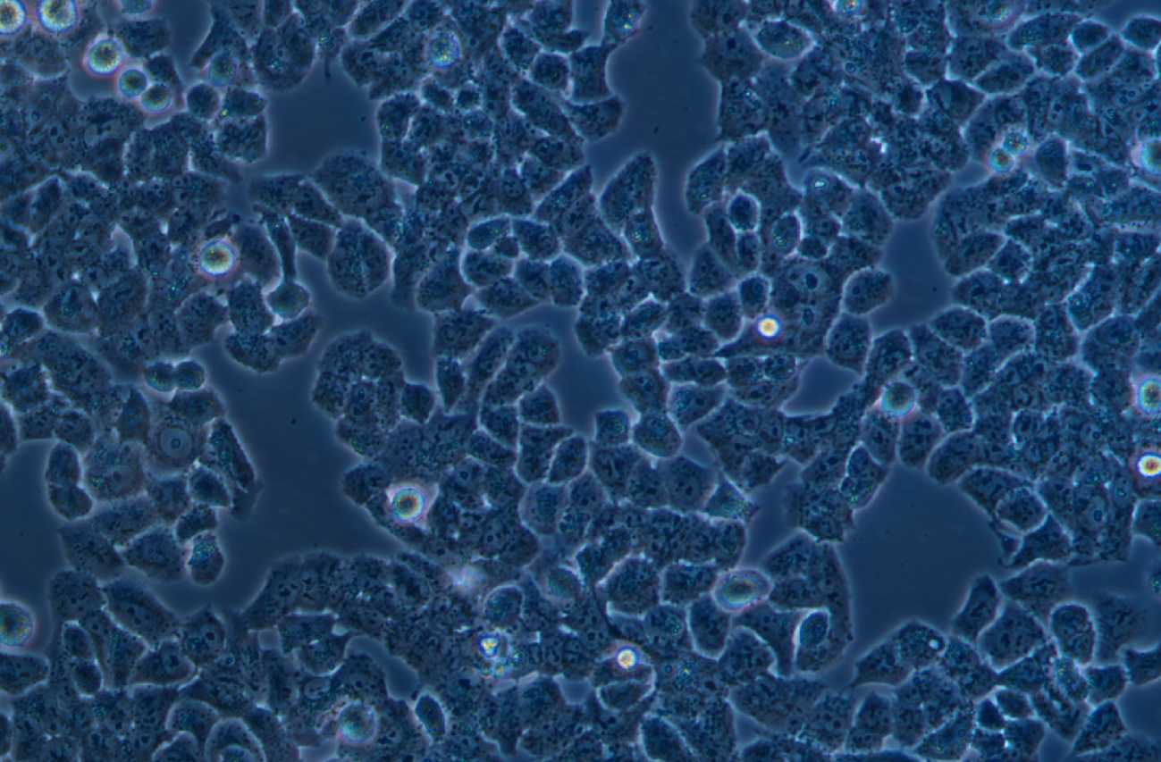 人卵巢癌顺铂耐药株A2780+DDP(STR鉴定正确)