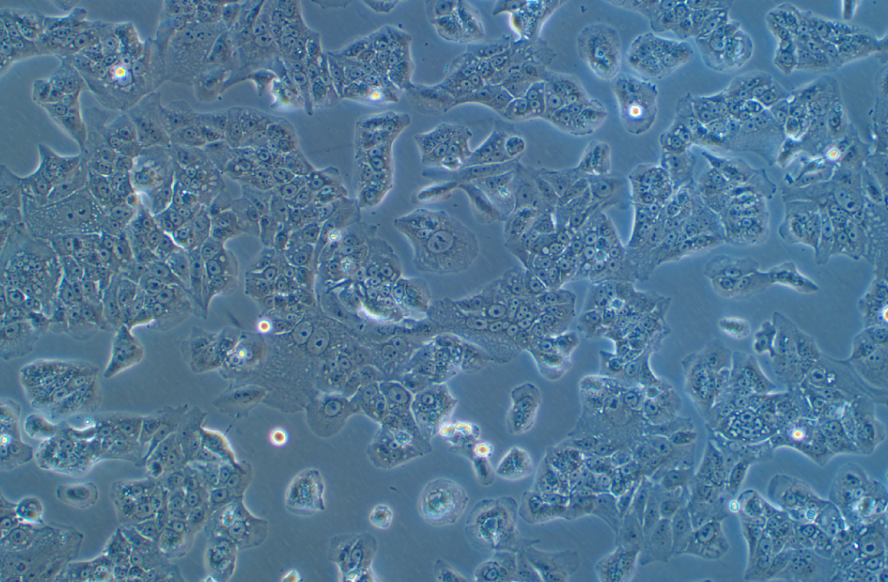 人肝癌细胞SNU368(STR鉴定正确)