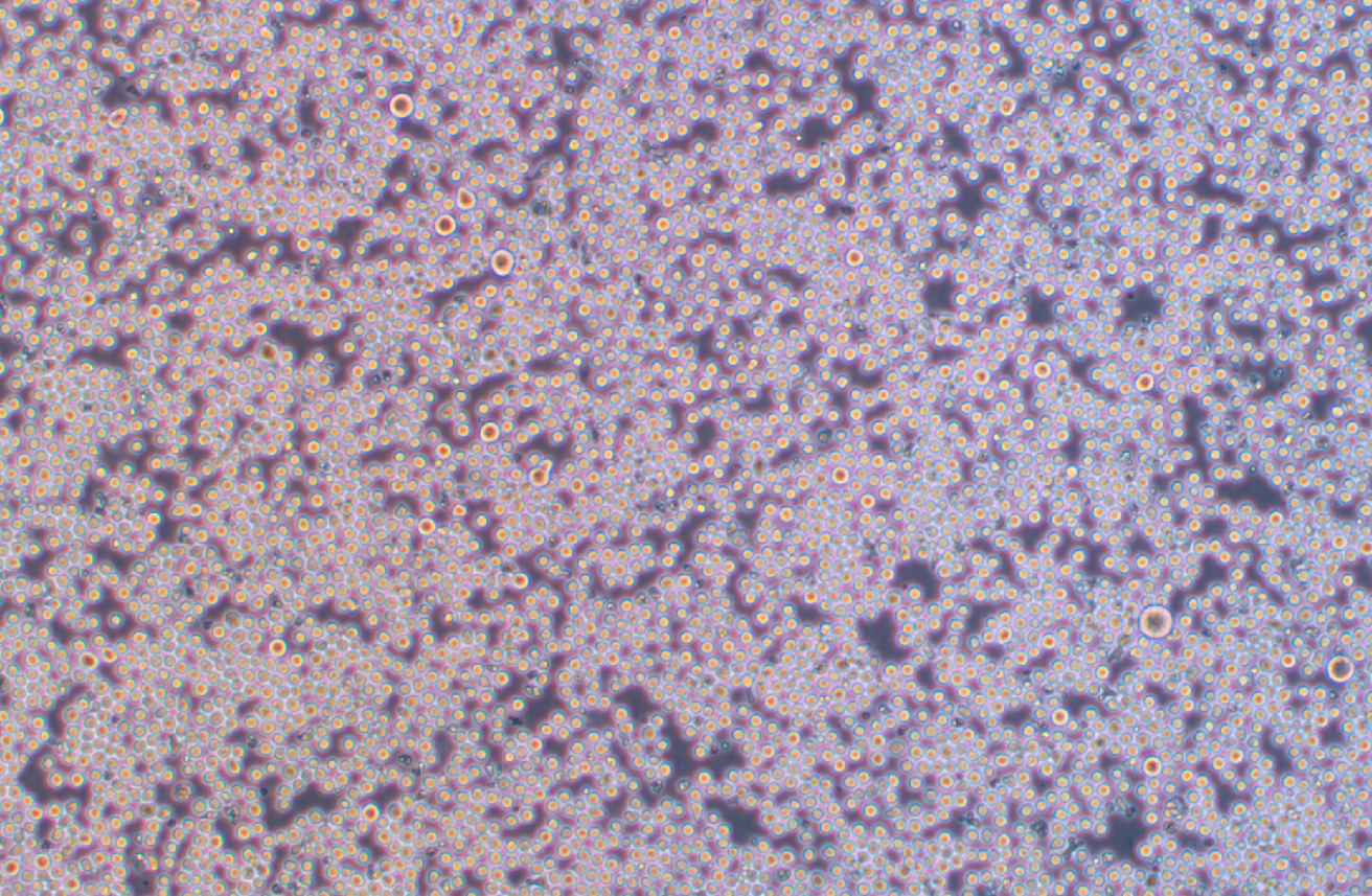 人急性髓系细胞白血病细胞KG-1A(STR鉴定正确)