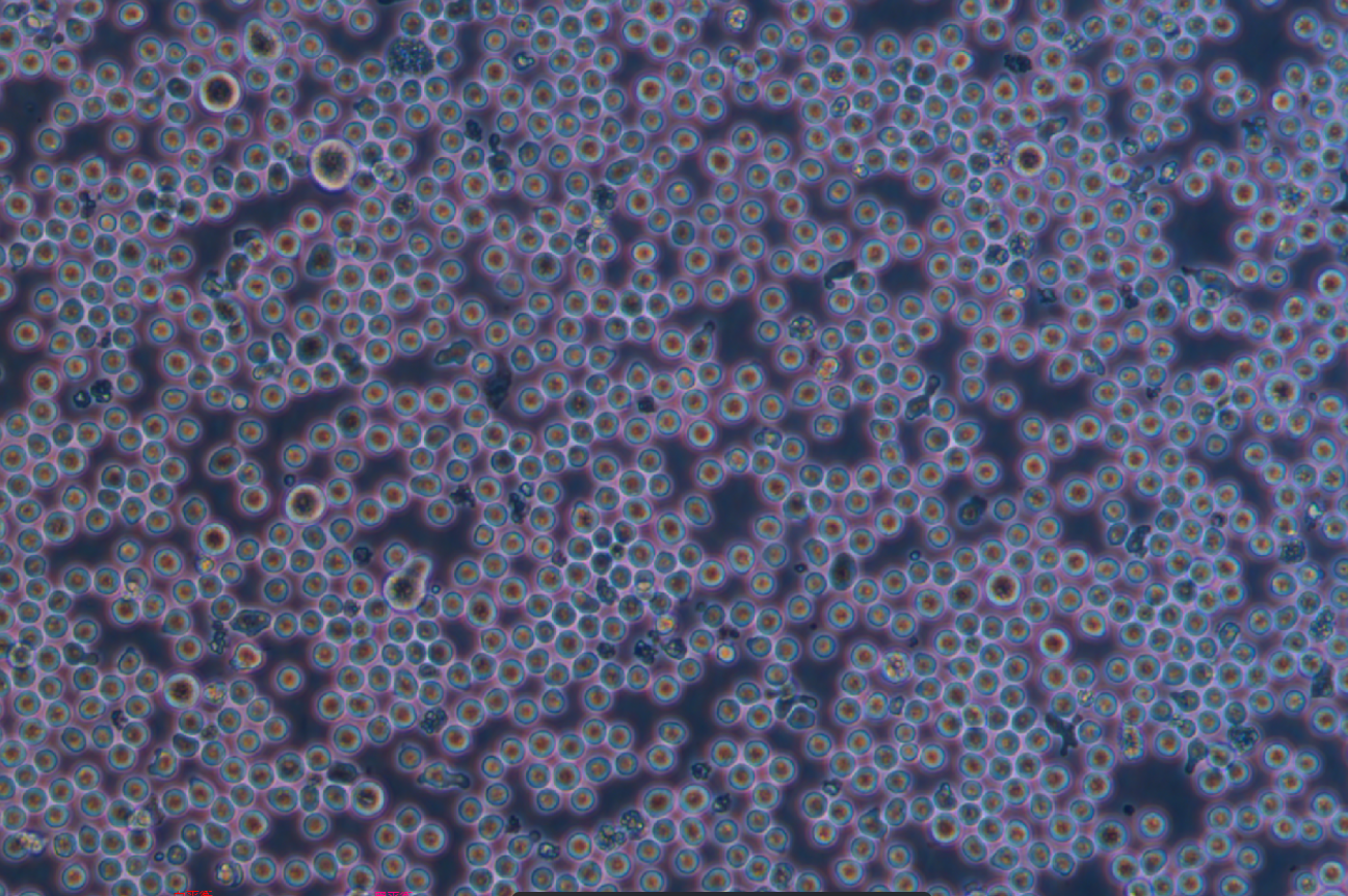 人急性髓系细胞白血病细胞KG-1A(STR鉴定正确)